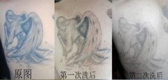 [太原纹身医院]关于纹身的那些事